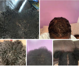 HEALTHY HAIR SYSTEM